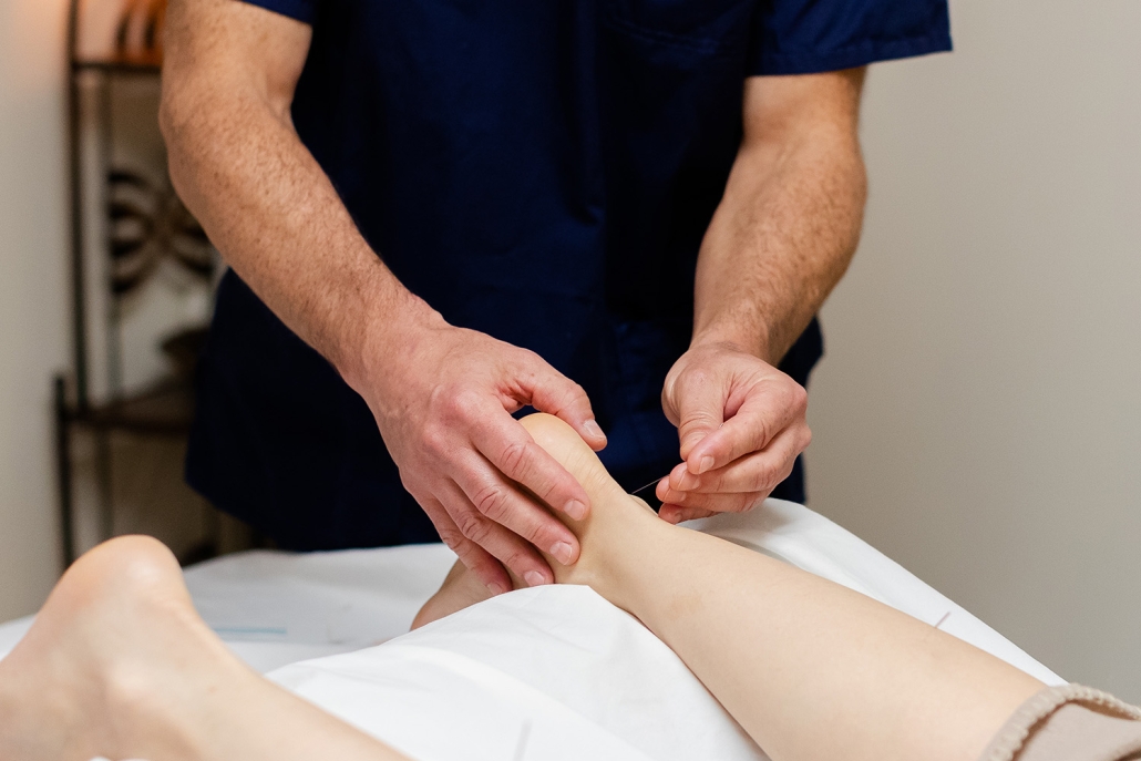 acupuncture on leg performed at Shen Dao Clinic