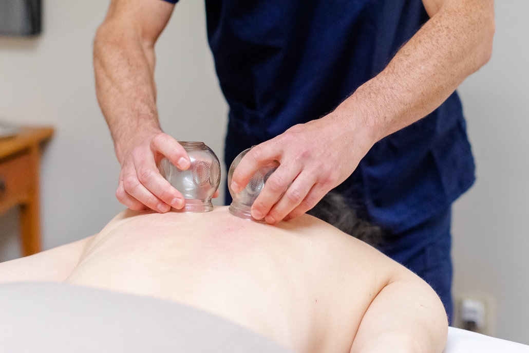 closeup of cupping on back